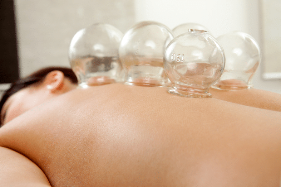 Massage Cupping et sport pourquoi les ventouses sont devenues l'arme secrète des sportifs