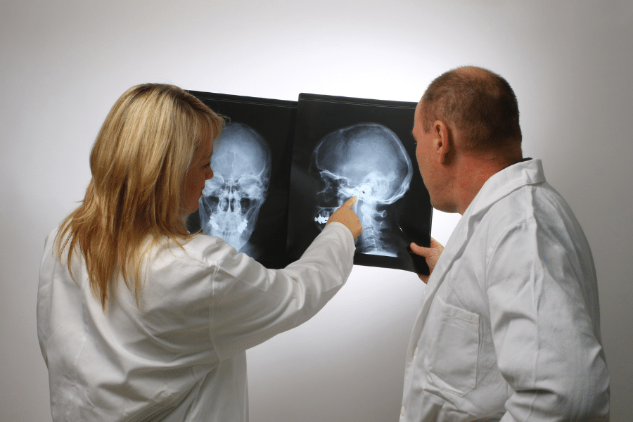 Reprendre le sport après une craniotomie protocole indications et recommandations 2026